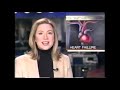 CBS HealthWatch Sponsored By Tylenol PM January 10 2003