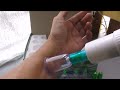 12 штук медицинские вакуумные банки с насосом на Aliexpress