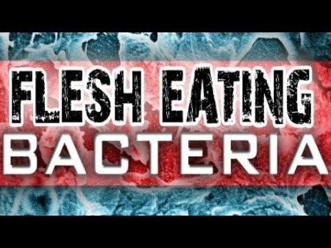 Man Dies from flesh Eating bacteria after Florida Beach Vacation Breaking News July 2019 Video