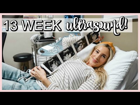 13 WEEK ULTRASOUND VLOG! COME TO MY APPOINTMENT WITH ME! | OLIVIA ZAPO
