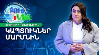 Կապտուկներ և արյունազեղումներ երեխայի մարմնին. Ե՞րբ դիմել արյունաբանի | Բուժ Ինֆո / Buj Info