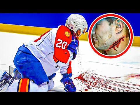 Unexpected NHL Moments: Near-Death Close Calls Revealed