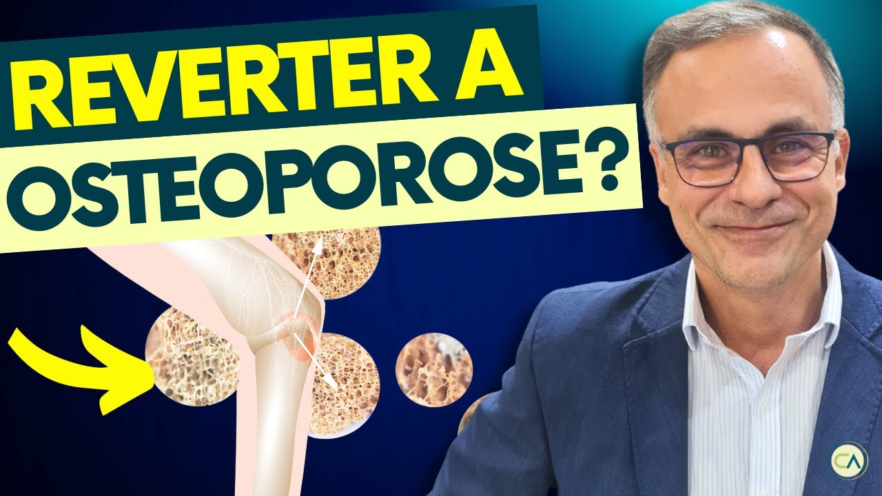 Osteoporose: MELHORES EXERCÍCIOS e Estratégias NATURAIS