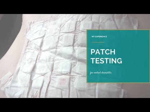 My Patch Testing Experience for Allergic Contact Dermatitis { Emily Jayne Weekly Vlog 25 }