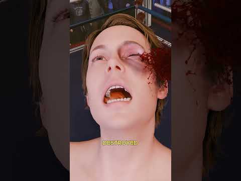 Boxing Gloves Filled With Plaster Of Paris 🥊