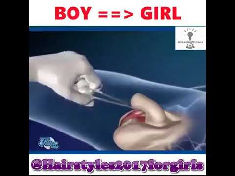 Veja Como é a Retirada do Pênis e dos Testículos na Cirurgia e a Construção da "Vagina"