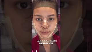 Download lagu Engfa Waraha before and after from teen to lady #engfawaraha #missgrandthailand2022copy mp3 Download lagu Engfa Waraha before and after from teen to lady #engfawaraha #missgrandthailand2022copy mp3