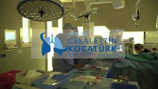 Prof.Dr. Celalettin Kocatürk - Videomediastinoskopi ve Torakoskopik Akciğer Rezeksiyonu Ameliyatı