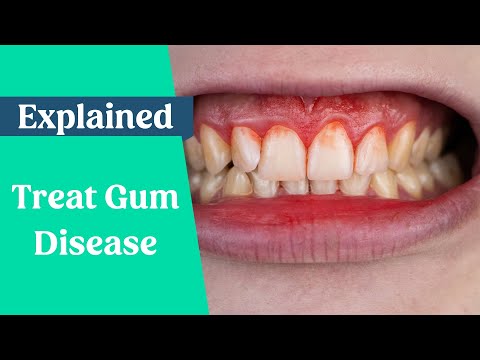 How to treat gum disease