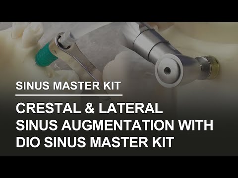 DIO Sinus Master Kit hands-on video