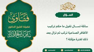 صورة تركيب الأظافر الصناعية || فتاوى عامة || د . سامي الواكد