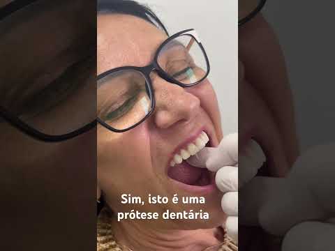 Prótese dentária superior com protocolo inferior