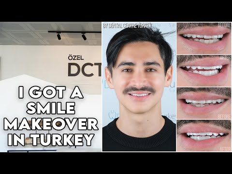 Getting Veneers in Turkey with the Dental Centre Turkey in Antalya