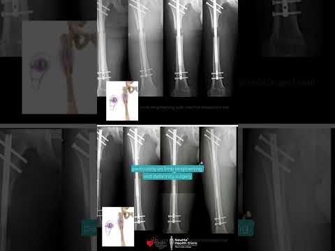 Prof. Dr. Ferhat Güler - Orthopedics and Traumatology