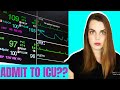 Why Would A Patient Go To The ICU? | ICU Basics