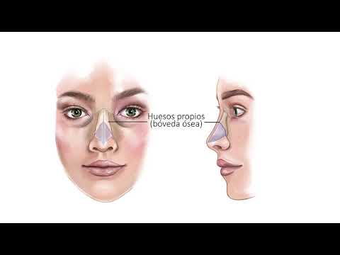 1 Anatomia de la nariz