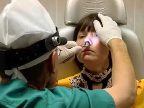 Врач оториноларинголог. Уха врач-отоларинголог. Радиоволновая вазотомия. Врач который смотрит нос. Отоларинголог.