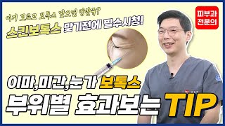 이마, 미간, 눈가 보톡스 잘 맞는 방법! 10년차 피부과원장의 꿀팁 대방출 (보톡스 효과, 노하우, 단점까지 총정리)