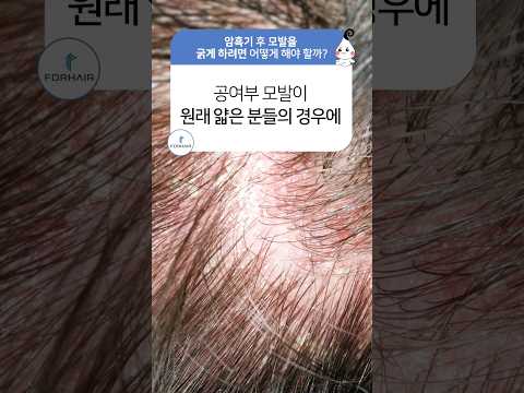 모발이식 후 머리가 굵어지지 않는다면ㅣ포헤어 부산