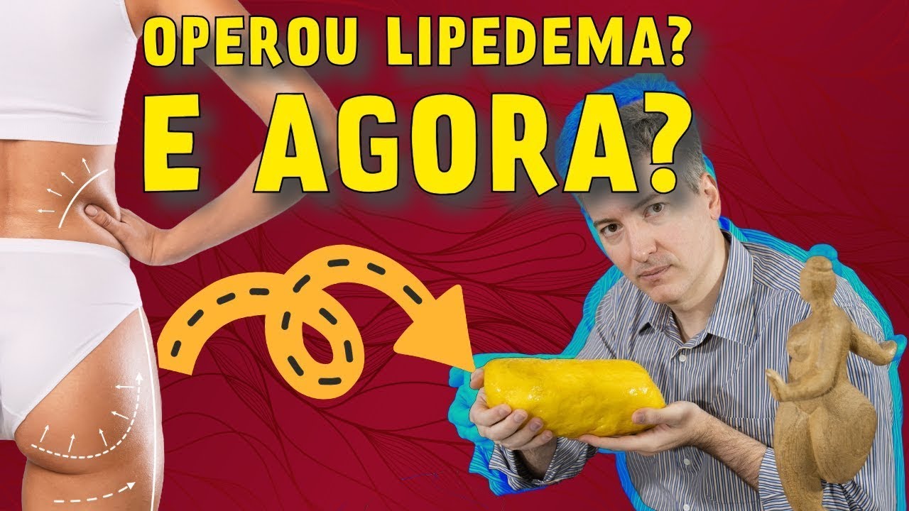 What is Life Like After Lipedema Surgery?