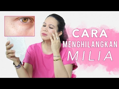 Obat tradisional untuk meningkatkan potensi pada pria dan harga Potensi miskin di 22