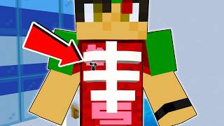 Namnam Needs Surgery in Minecraft!