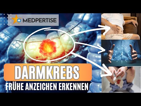 Ihr Stuhl verrät mehr, als Sie denken: Frühe Anzeichen für Darmkrebs, die jeden betreffen können.