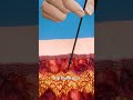 How To Remove Porcupine Quills