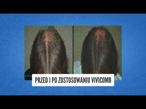 Ciekawe produkty do włosów Olej do włosów Dabur oleju amly kupować