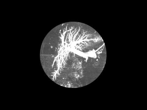 Video thumbnail for Skin Song
