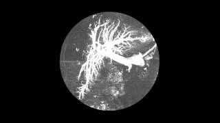 Skin Song by Bat For Lashes