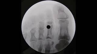 Omen's Jot – Blood Hook