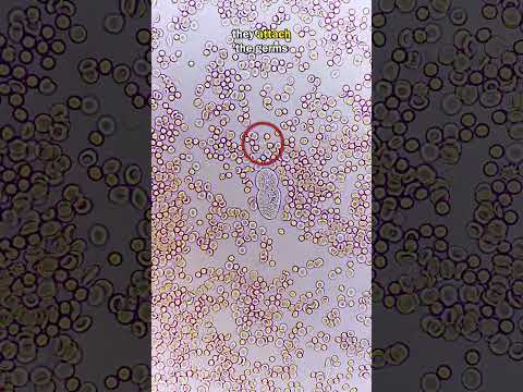 White Blood Cell Fights GIANT GERM!