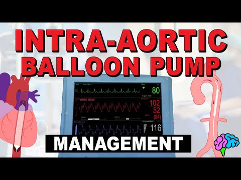 Management of the Intra-Aortic Balloon Pump (IABP)