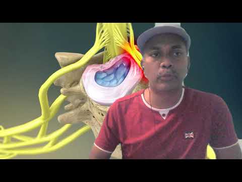 Cervical Neck pain, kalluthu vali, thollpattai vali, neck disc bulge, ne...