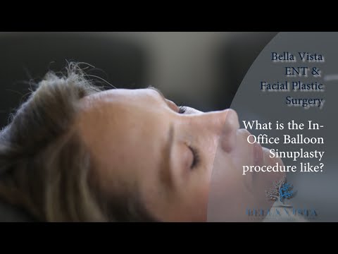 In-Office Balloon Sinuplasty Procedure - No General Anesthesia Required