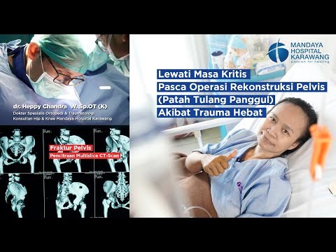Lewati Masa Kritis Pasca Operasi Rekonstruksi Pelvis (Patah Pulang Panggul) Akibat Trauma Hebat