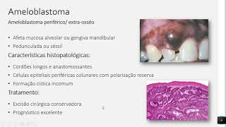 Tumores Odontogênicos - Resumos de Odonto