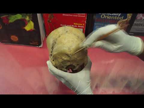 download lagu mp3 mp4 Obelion Suture, download lagu Obelion Suture gratis, unduh video klip Obelion Suture