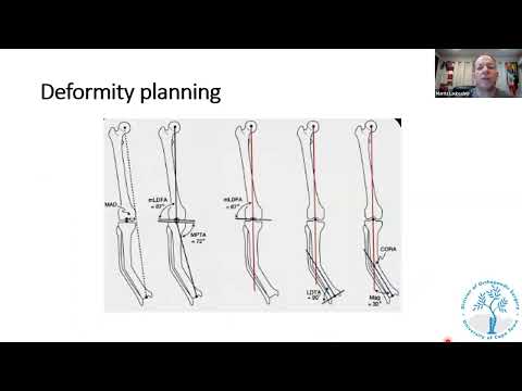 Maritz Laubscher- Principles of deformity correction