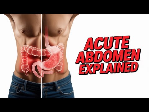 Diagnosis and Management of Acute Abdomen
