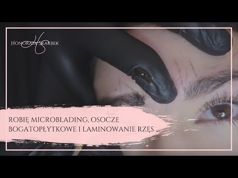 Jakie witaminy są potrzebne na wypadanie włosów Maska do włosów, które nie porysować głowami