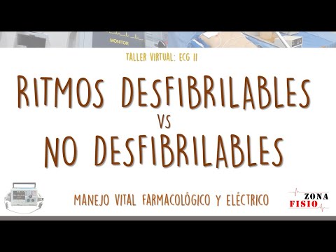 TALLER VIRTUAL: ECG II / E4 / RITMOS DESFIBRILABLES VS RITMOS NO DESFIBRILABLES