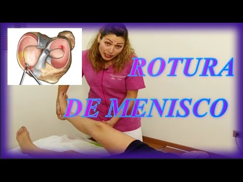 Osteocondrosis de toda la espalda y el saliente de la columna cervical Preparación de infusiones de los bigotes de oro para las articulaciones
