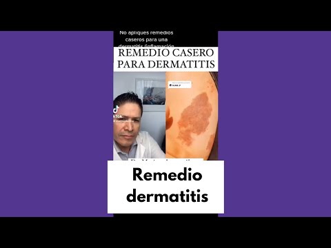 , title : '¿Remedio casero para la dermatitis?'
