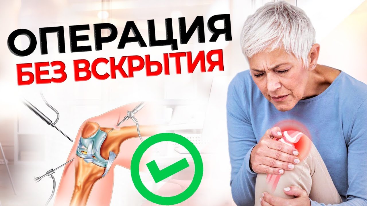 Выпот в суставе виды. Причины выпота в коленном суставе у ребенка через несколько часов после. Диагностическая артроскопия | Травматология в клинике Красная Горка. Презентация на тему: "Выполнила : Шарипова И. Р. это дегенеративно.