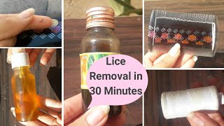Lice Removal Treatment At home | Lice eggs, Nits, lice remedy- Remove lice from head - Glow Yourself