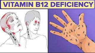 Vitamin B12 Deficiency Symptoms That Should Never Be Ignored