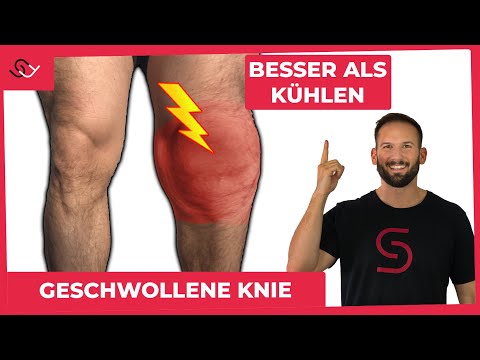 Geschwollene Knie - DAS musst du wissen - hilfreicher Trick