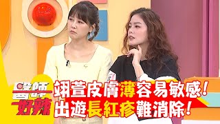 翊萱皮膚薄容易敏感！出遊長紅疹難消除！【#醫師好辣】20250614 E1733 part2